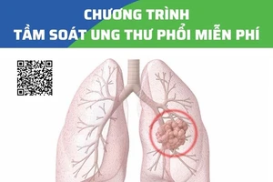 Khám, tầm soát ung thư phổi miễn phí 