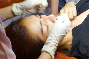 Một phụ nữ đang nâng mũi tại một spa kém chất lượng