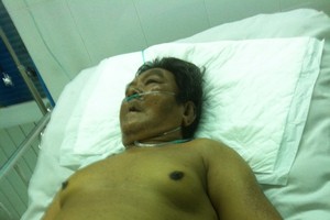 由於病情嚴重，文榮仍留在重症急救室接受治療。