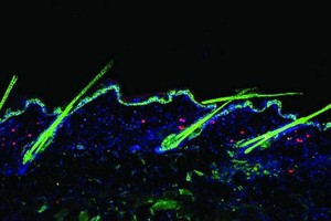 調節性T細胞（紅色）參與毛髮（綠色）的生長。（圖片來源：論文）