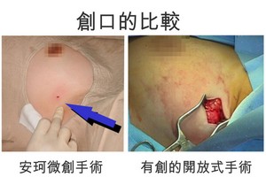 （資料圖源：聖丹福廣州現代腫瘤醫院）