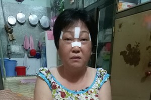 蔡玉蘭病情反覆發作，導致頭劇痛、眼睛紅腫、血壓下降。