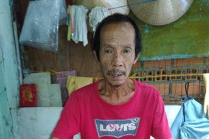 文光平多年來未能治癒膽結石病。