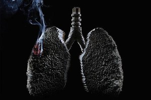 預防肺癌從以下５點做起。（示意圖源：互聯網）