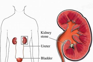 老忘事別怪大腦，可能是腎臟撐不住了。（圖源：互聯網）
