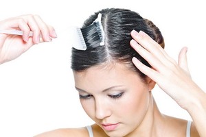 為何那麼多年輕人長白髮。（示意圖源：互聯網）