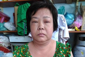 鍾寶絲家境貧困又不幸受了重傷。