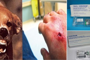 狂犬病疫苗短缺。（示意圖源：互聯網）