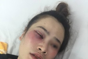 傷者陳氏瓊茹當前還在住院接受治療中。（圖源：金塋）