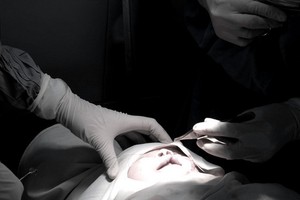 市醫療大學醫院從本月12至19日將展開為兔唇兒童免費診斷與施行手術活動。（示意圖源：互聯網）