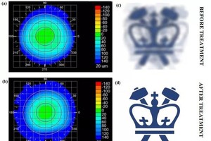 接受治療前後的角膜形態（左），以及模擬的視覺效果變化（右）。（圖源：自然-光子學）
