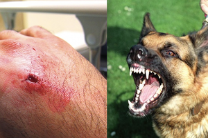 小心狗狗惹禍。（示意圖源：互聯網）