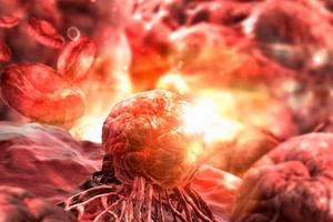 新科技研發：在人體內裝 GPS 定位腫瘤。（圖源：Colin Anderson）