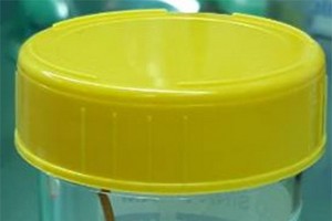 經內窺鏡手術從患者的小腸取出長約6釐米的牙籤。（圖源：醫院提供）