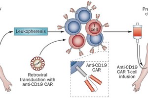 CAR-T 細胞免疫療法示意圖。