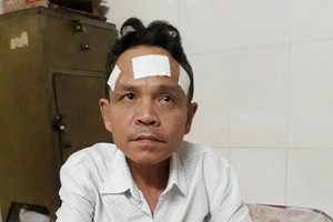 劉偉超目前還經常頭暈頭痛。