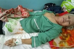 夏大娘的手術成功，但傷處還很痛。