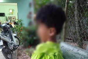 遭班主任罰打屁股到瘀傷的一年級小學生。（圖源：互聯網）