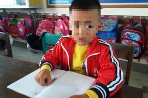 遭老師連摑兩巴掌致腦震盪的一年級小學生張玉海。（圖源：阮強）