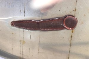 醫生從病人鼻孔內夾出一條長約5公分的活水蛭。（圖源：醫院提供）