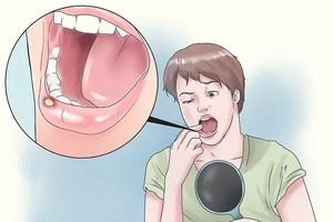 （示意圖源：互聯網）