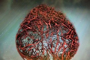 研究團隊培植出堪稱完美的3D人體血管模型。