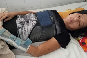 王女正等錢施手術。