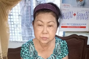 近期，陳銀兒的臉部開始浮腫。