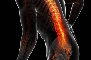 便秘竟是腰椎間盤突出所致。（示意圖源：互聯網）