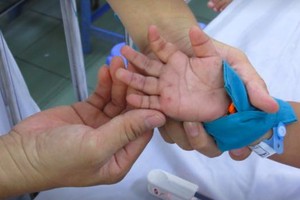 市衛生防疫中心：登革熱、手足口、麻疹傳染病例的新增病例呈下降趨勢。（示意圖源：互聯網）