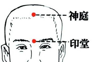 腦疲勞、難眠，多按神庭穴。（圖源：互聯網）