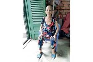 卵巢癌病患者急須幫助