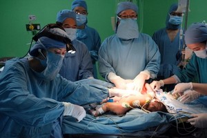 手術團隊成功分離了兩名共享肝臟連體女嬰。（圖源：T.C）