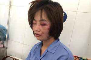 遭一夥青年毆打滿臉傷勢的巴士女乘務員Đ.T.H。（圖源：嘉團）