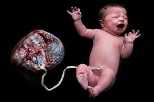 孕產婦在家順產自然分娩一直以來發生了不少母嬰死亡的悲慘案例。（示意圖源：田升）