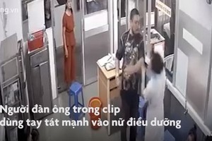 圖中顯示，一名男子用左手掌摑護士的右臉。（圖源：監控視頻截圖）