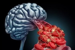 （示意圖源：互聯網）