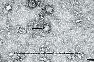 新型冠狀病毒在顯微鏡下的圖片。（圖源：新華社）