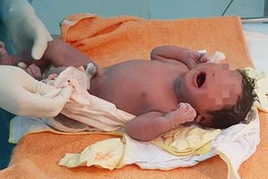 經過40分鐘剖腹手術一名3公斤重的男嬰順利問世。（圖源：院方提供）