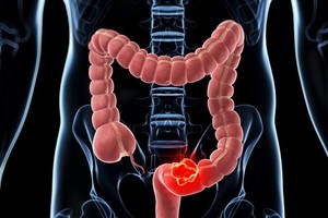 （示意圖源：互聯網）