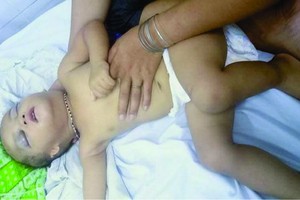 兩歲的小孩受重傷。（圖源：陳常）