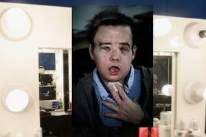 哈莫公開他接受第二次手術後的面貌。（圖源：互聯網）