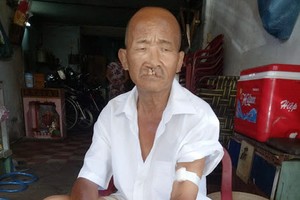 林偉山多年來受腎病折磨。