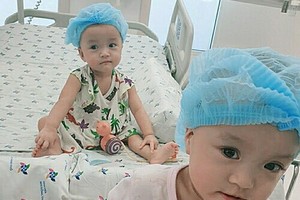 連體女嬰竹兒-妙兒成功分離一個多月後健康良好。（圖源：院方提供）