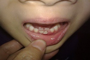 （示意圖源：互聯網） 