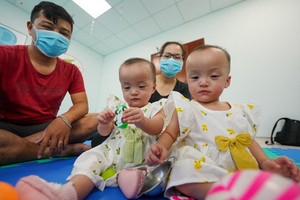 手術分離100天後的孿生小姐妹竹兒與妙兒。（圖源：院方提供）