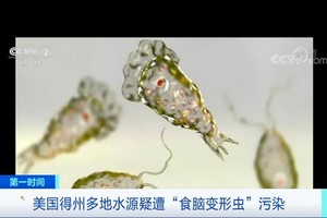 這種單細胞生物經鼻腔進入人腦後可引發原發性阿米巴腦膜腦炎。（圖源：CCTV視頻截圖）