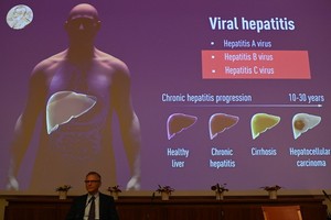 ３種主要肝炎中，丙型肝炎一度是造成慢性肝炎的神秘原因。（圖源：AFP）