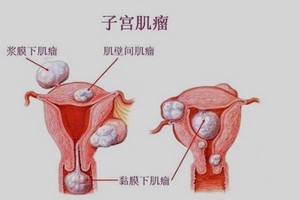 （示意圖源：互聯網） 