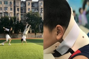 因模仿抖音(TikTok)視頻上的翻跟斗動作而扭傷了頸椎的10歲男童（右圖）。（圖源：田升）